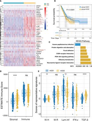 JAG1 is correlated to suppressive immune microenvironment and predicts immunotherapy resistance in lung adenocarcinoma